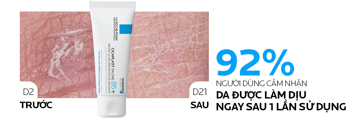 Mô tả Kem phục hồi La Roche-Posay Cicaplast Baume B5+ giúp phục hồi da sau 1 lần sử dụng - phiên bản 40ml - 5