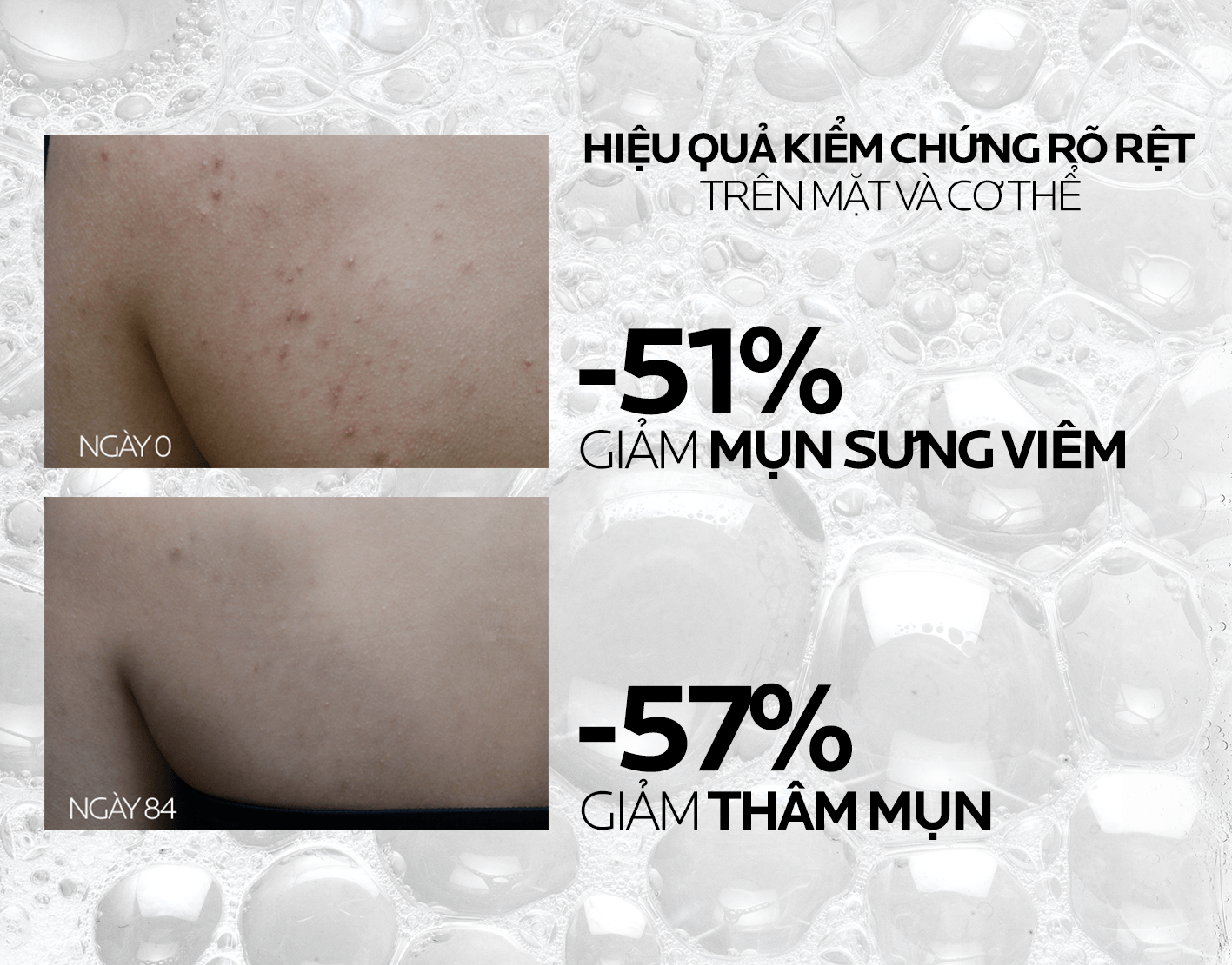 Mô tả Gel rửa mặt và tắm La Roche Posay Effaclar Micro-Peeling Purifying Gel 400ml - 3