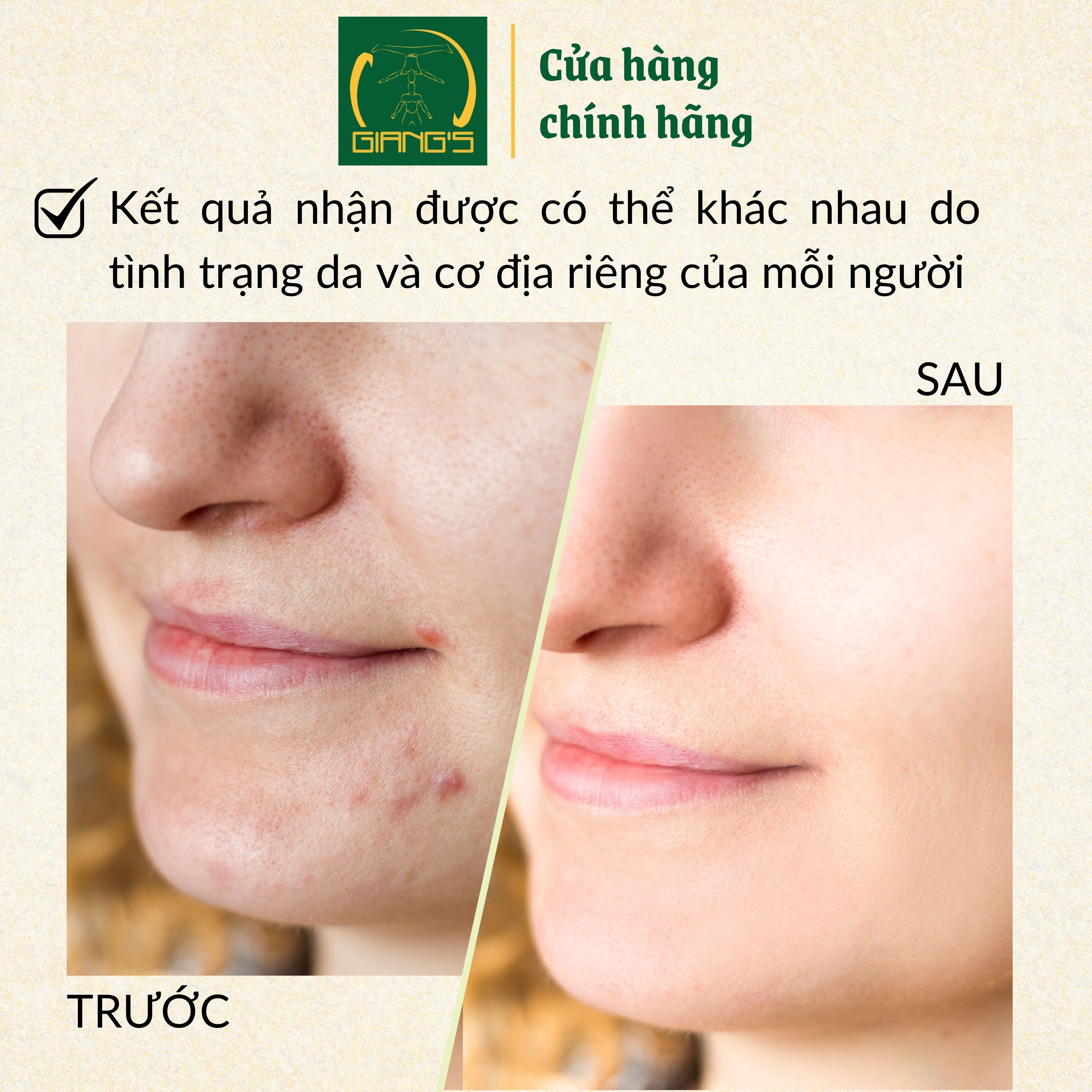Mô tả Nước cân bằng (toner) giàu khoáng dành cho da hỗ hợp JASMINUM HERBAL EXTRACT TONER ALCOHOL-FREE 200ml - Giang's - 1