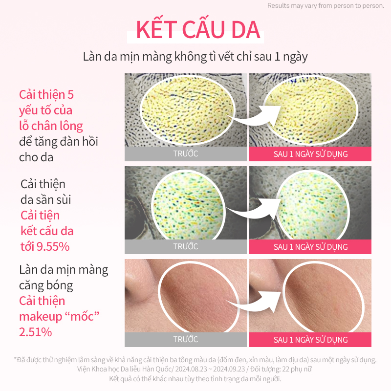 Mô tả Kem Dưỡng Ban Đêm hince Kingsberry Vita Night Cream - 7