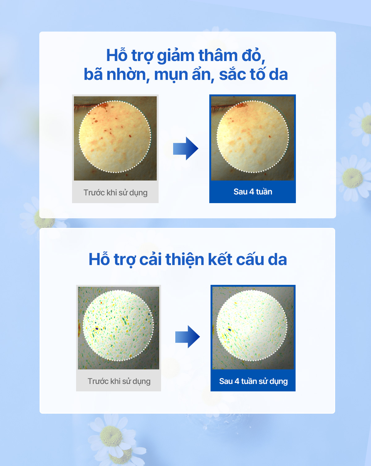 Mô tả Kem dưỡng ẩm, hỗ trợ tái tạo da Midnight Blue Clearing Water Cream 50g - 6