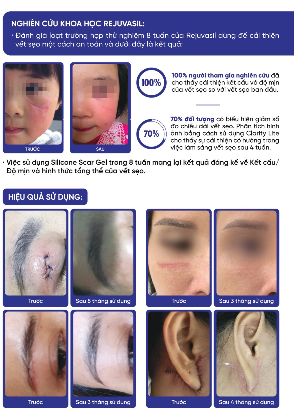 Gel Rejuvasil 30ml - Ảnh 3