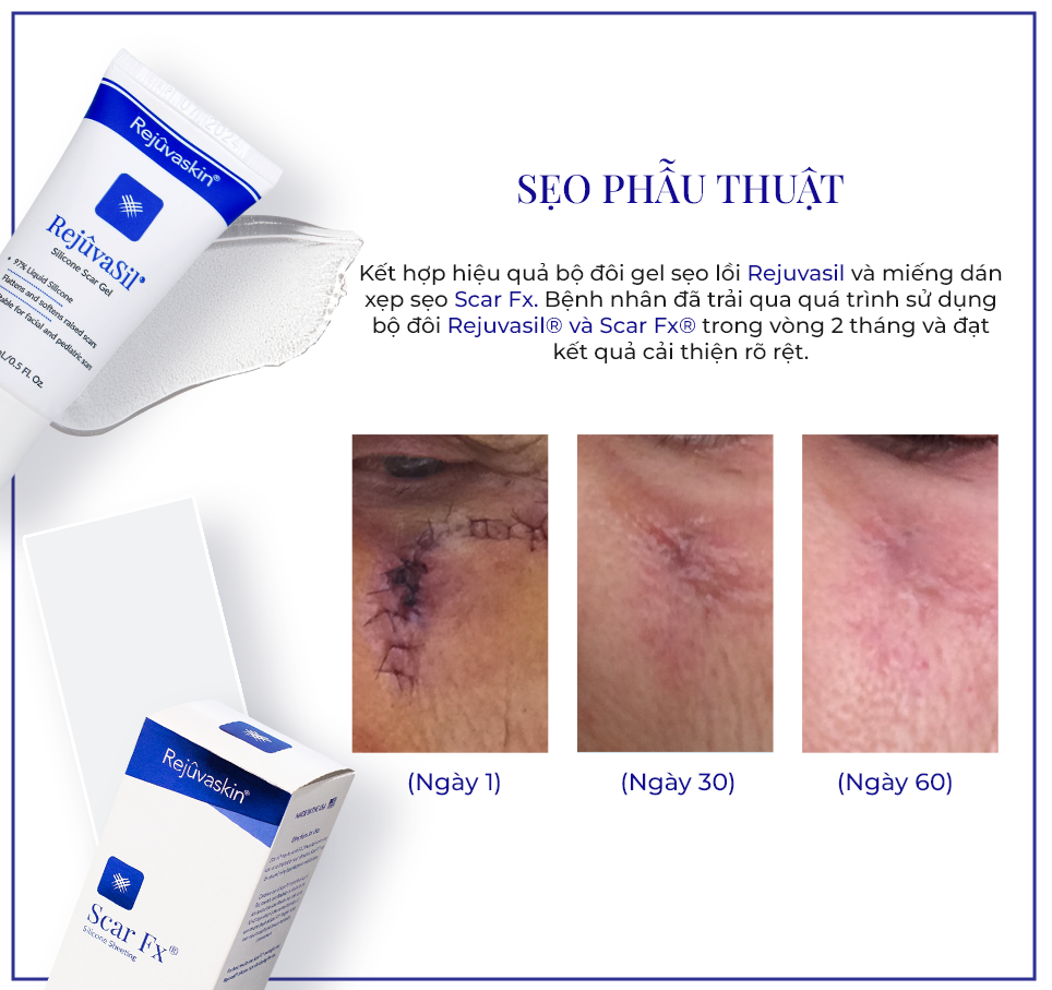 Gel Rejuvasil 30ml - Ảnh 8