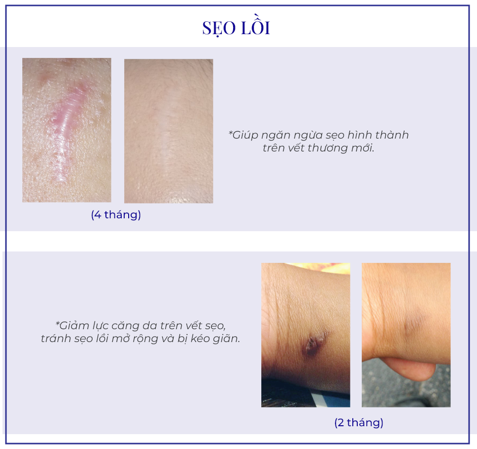 Gel Rejuvasil 30ml - Ảnh 9