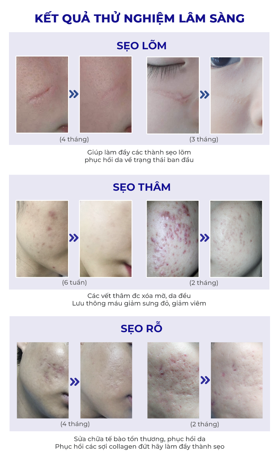 Kem Scar Esthetique 10ml - Thông tin thêm