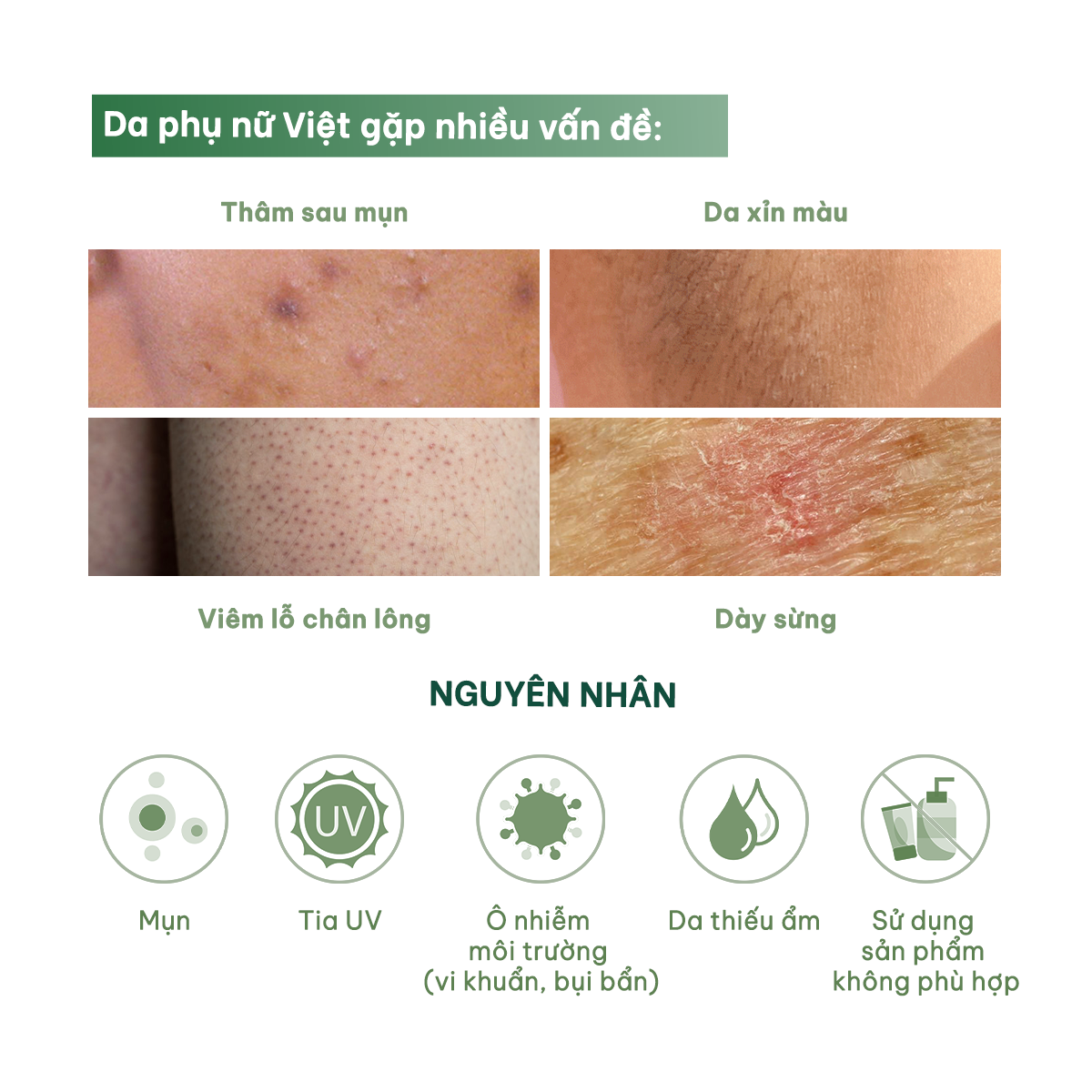 Mô tả Peel da giúp làm sáng, giảm thâm mông, nách, bikini, đầu gối, khuỷu tay AHA 25% BareSoul Glowy Body Peel 50g - 3