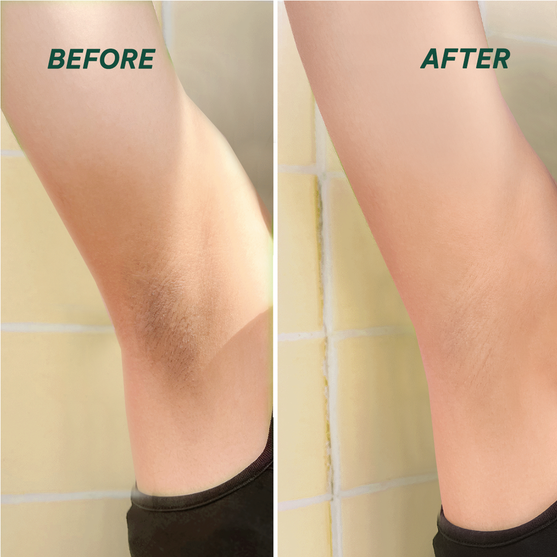 Mô tả Peel da giúp làm sáng, giảm thâm mông, nách, bikini, đầu gối, khuỷu tay AHA 25% BareSoul Glowy Body Peel 50g - 8