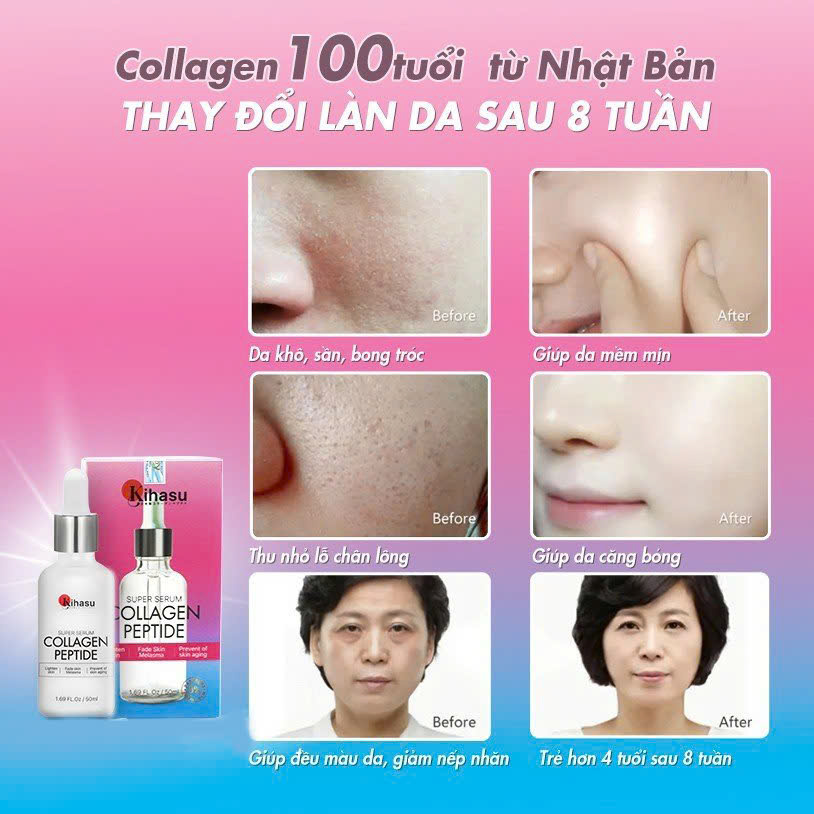Mô tả Serum Collagen Kihasu Dưỡng Trắng Da, Cấp Ẩm, Chống Lão Hóa, Se Khít Lỗ Chân Lông, Phục Hồi Da - 2