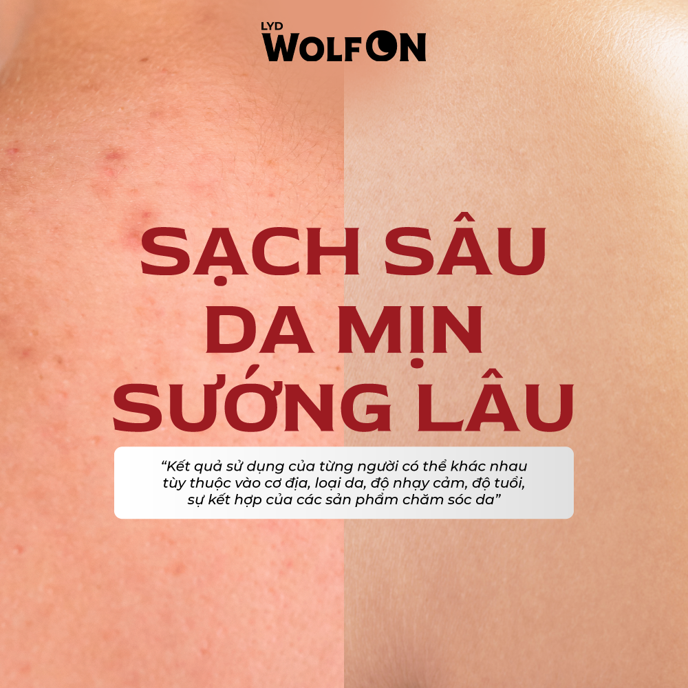 Mô tả Sữa Tắm Nam Giới 2IN1 Tẩy Tế Bào Chết LYD Wolf ON Shower Scrub Gin 69 Sạch Sâu, Mịn Da, Giảm Mụn 50ml, 350ml - 5