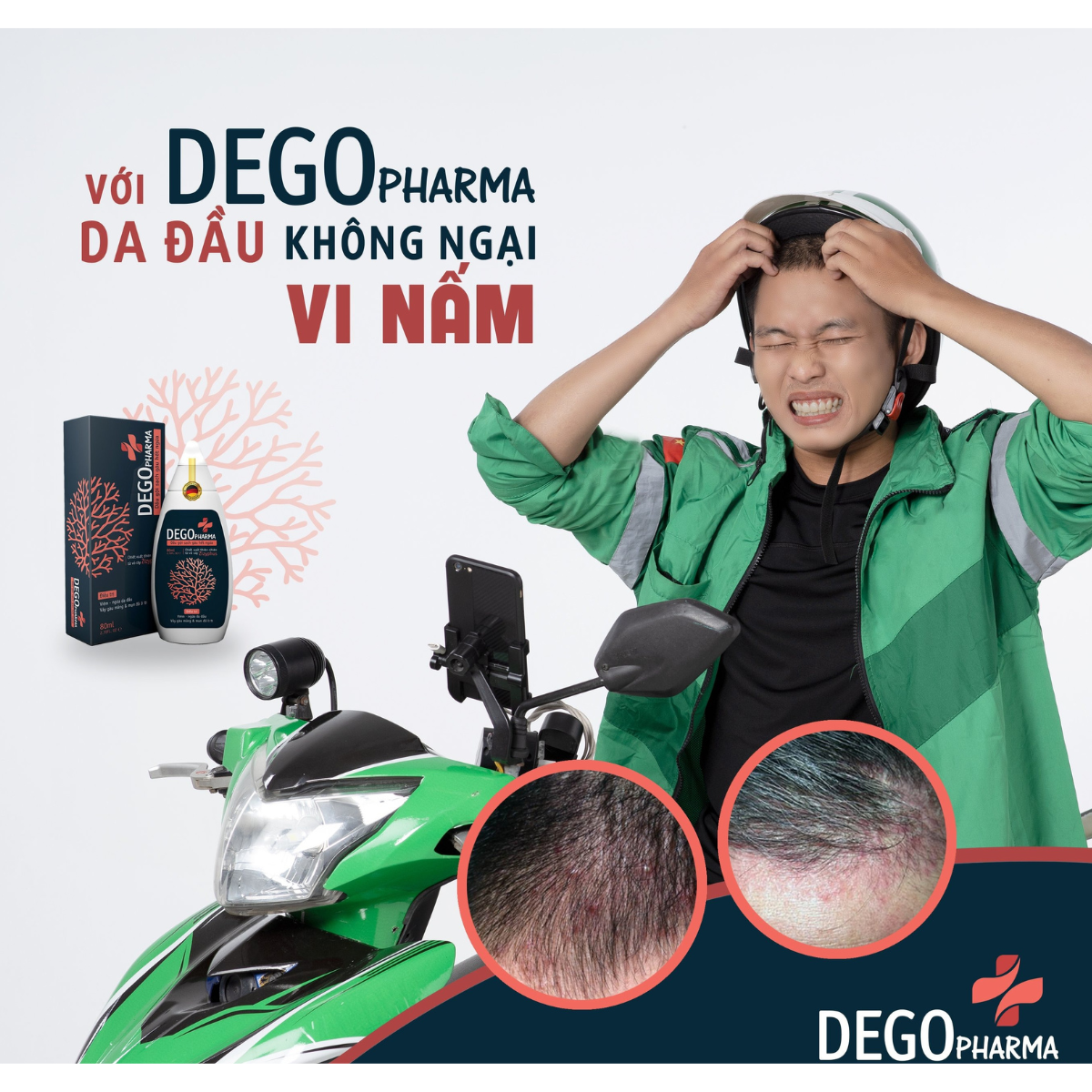 Mô tả Dầu Gội Sạch Gàu Sau 1 Tuần DEGO PHARMA 80ml Hết Gàu Ngứa Làm Mát Da Đầu Hiệu Quả - 2