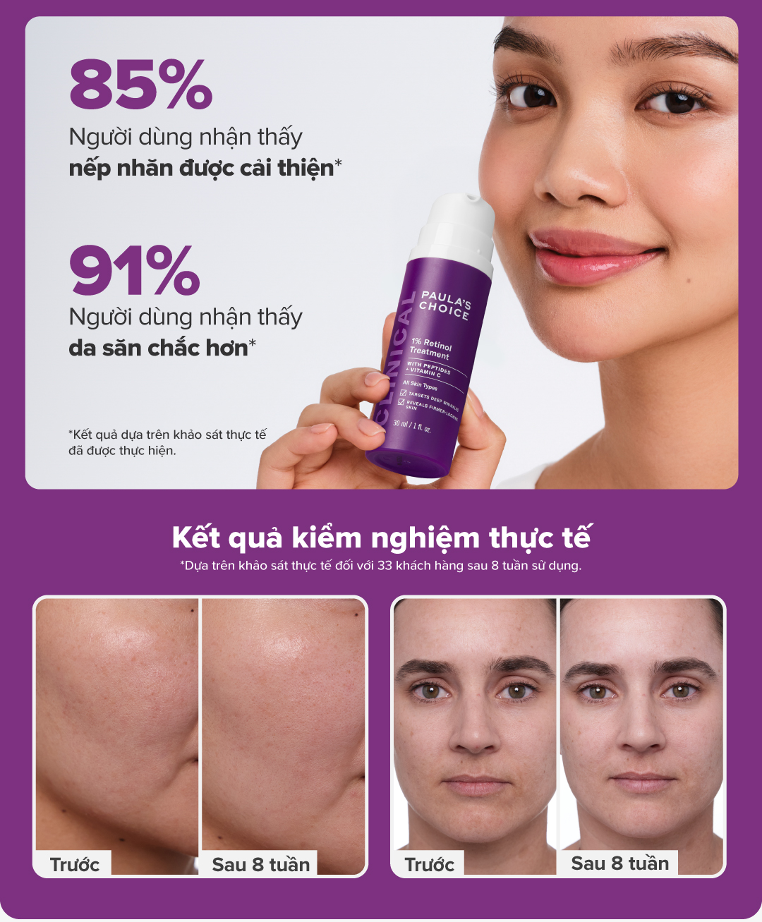 Mô tả Tinh chất làm mờ nám và nếp nhăn Paula’s Choice Clinical 1% Retinol Treatment 30 ml 8010 - 2