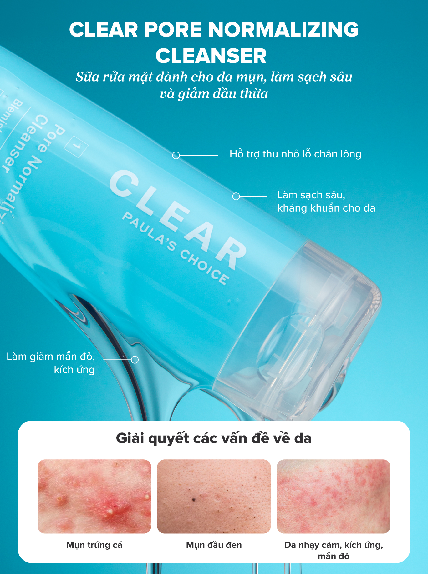 Mô tả Sữa rửa mặt ngăn ngừa mụn Paula’s Choice Clear Pore Normalizing Cleanser 177 ml 6002 - 1