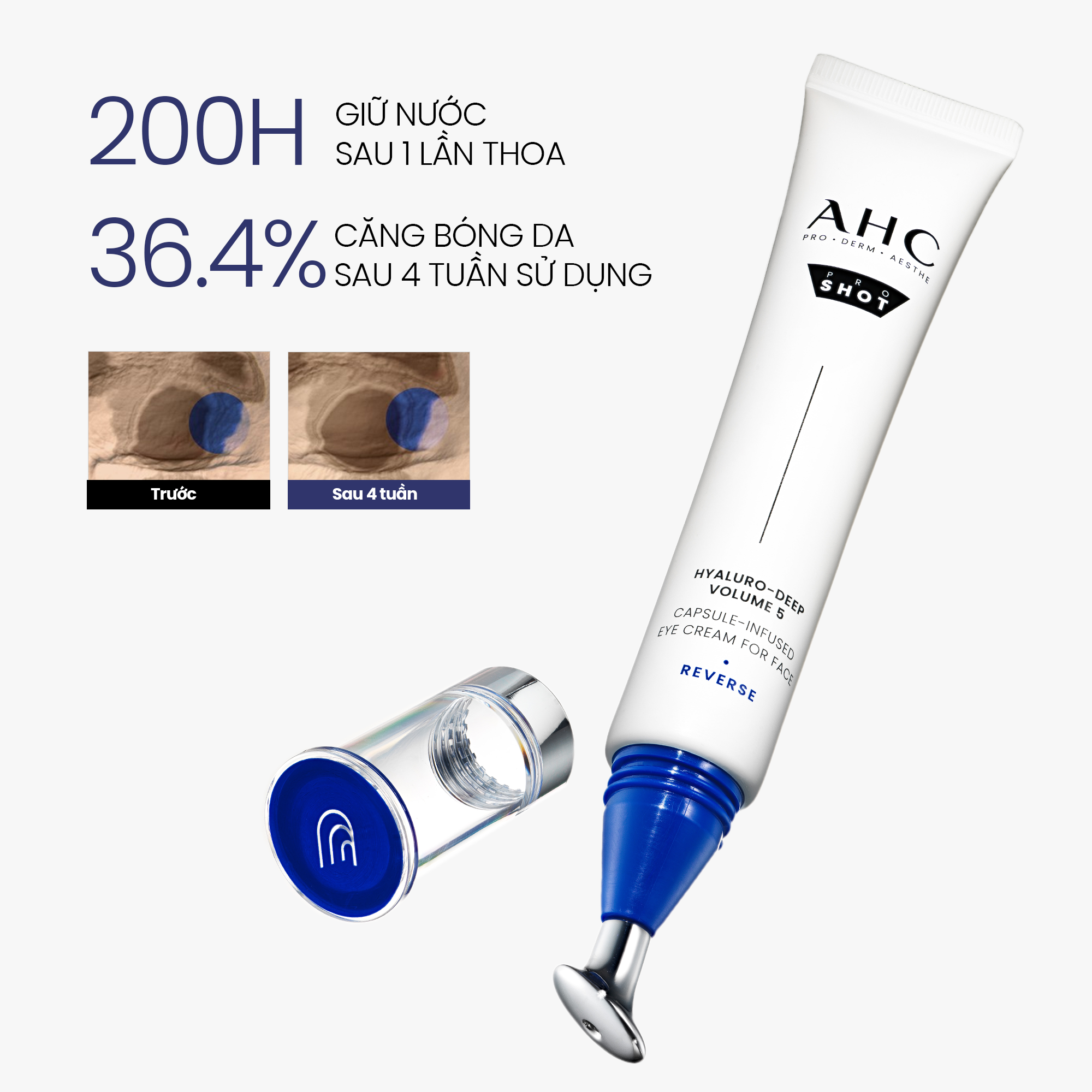 Kết quả dùng Kem AHC Hyaluro-Deep Volume 5
