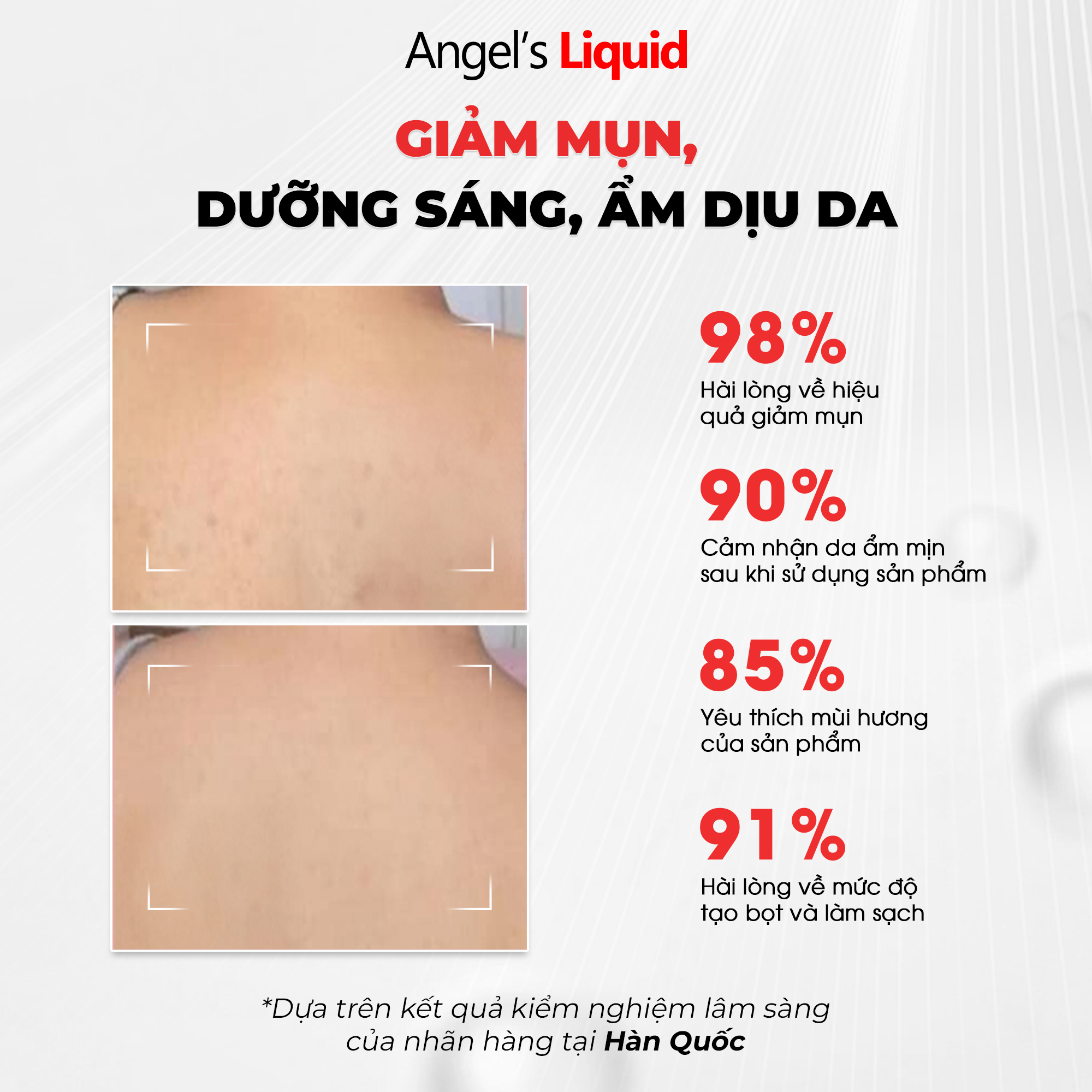 Mô tả Sữa Tắm Giảm Mụn, Dịu Ẩm Làn Da Angel's Liquid Glutathione + BHA Exfoliating Body Wash 500ML - 5