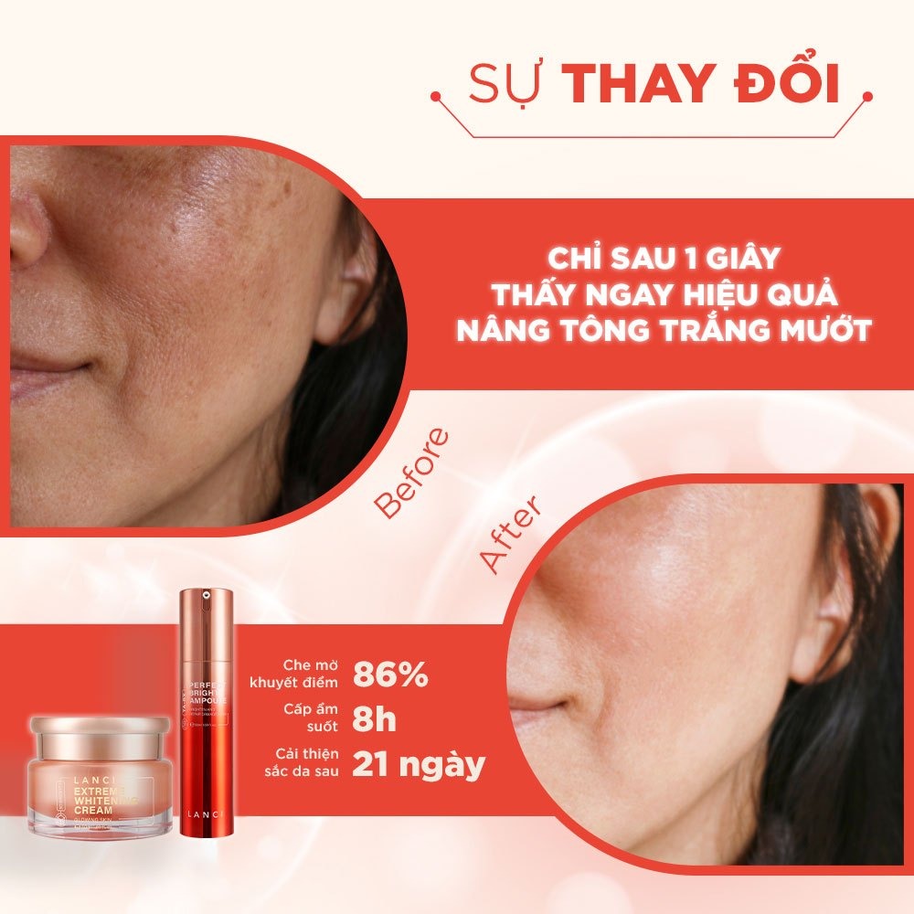 Mô tả Bộ đôi Serum mờ nám 50ml và Kem dưỡng trắng 50ml LANCI dưỡng da trắng mướt - 3