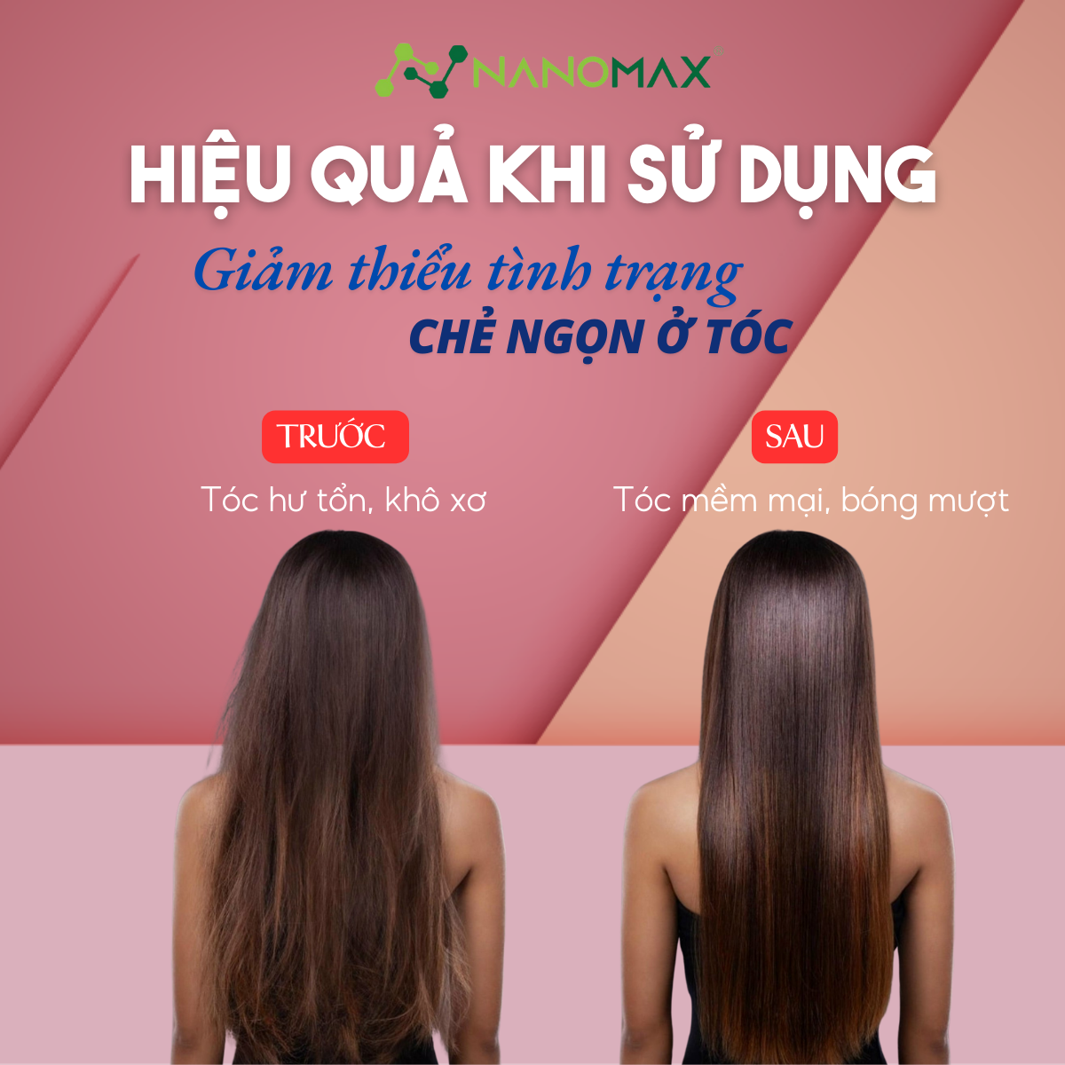 Mô tả Máy Sấy Tóc Nanomax Z-10 Sấy 2 Chiều Nóng Lạnh, Đèn Led 3 Chế Độ Nhiệt, Tốc Độ Sấy, Công Suất 1500w Nhanh Khô - 7