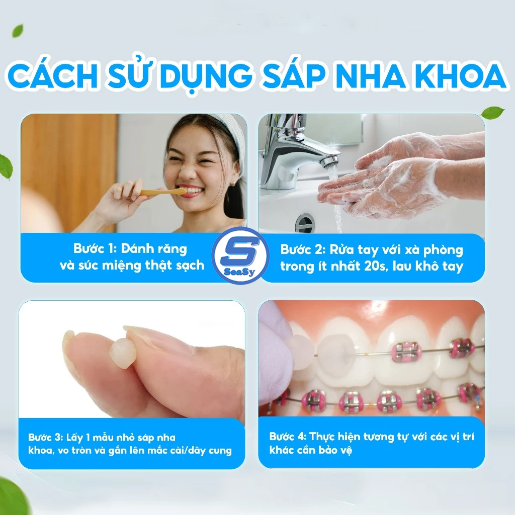 Sáp nha khoa niềng răng SeaSy 3M Unitek - Sáp chỉnh nha hỗ trợ giảm đau ...