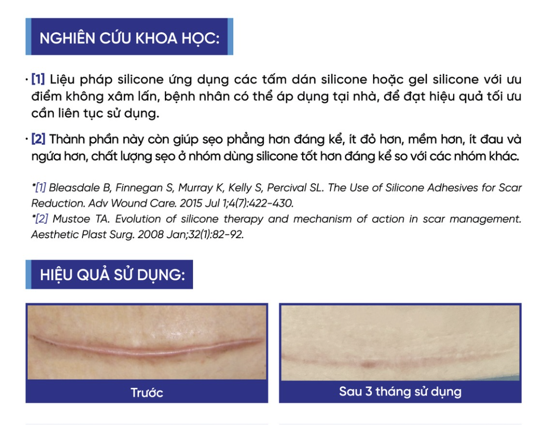 Hiệu quả trị sẹo với Scar FX