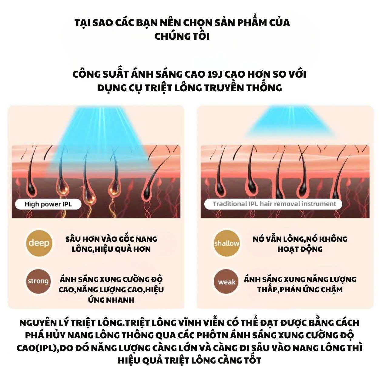 Mô tả Máy triệt lông ENZO cao cấp, công nghệ IPL giảm thâm trẻ hóa da, triệt lạnh ICE, Bảo Hành 10 Năm - 4