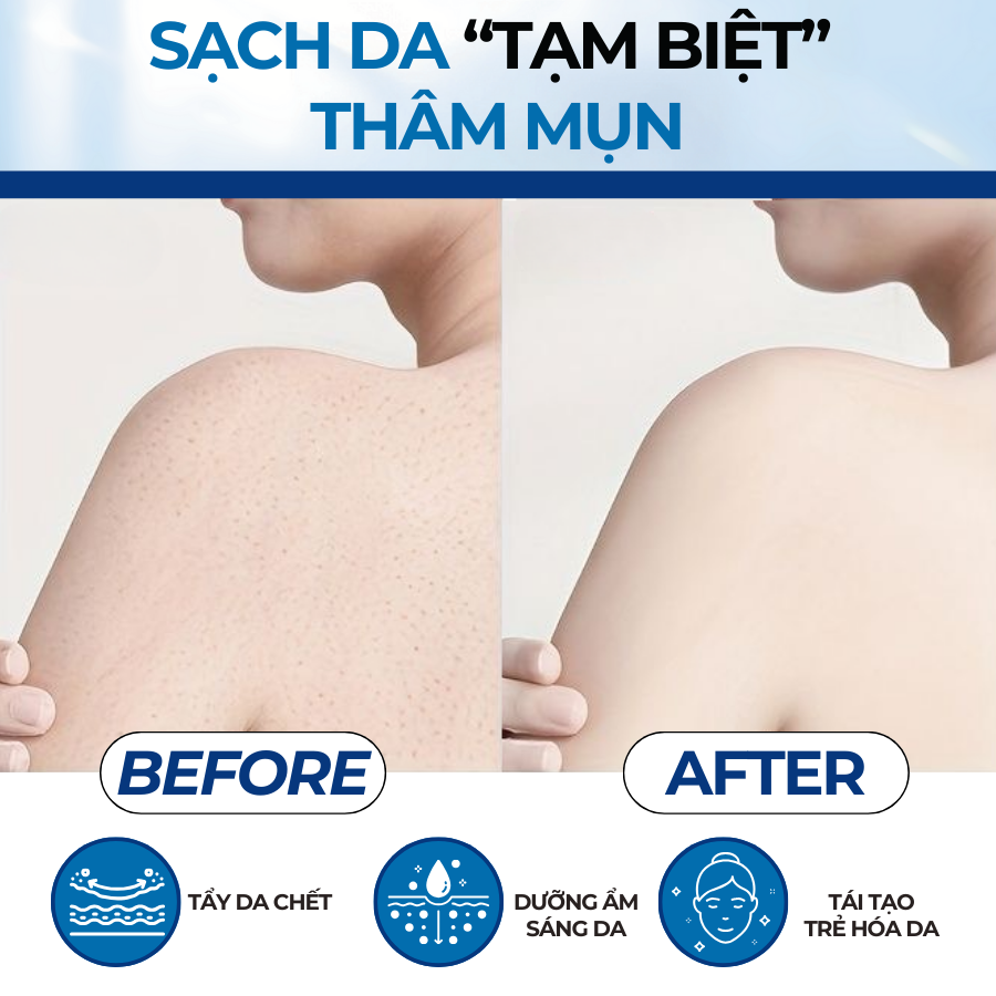 Mô tả Tẩy Da Chết Cho Cơ Thể Compliment 400ml Giúp Da Mềm Mượt, Bóng Khỏe, Sáng Mịn - 8