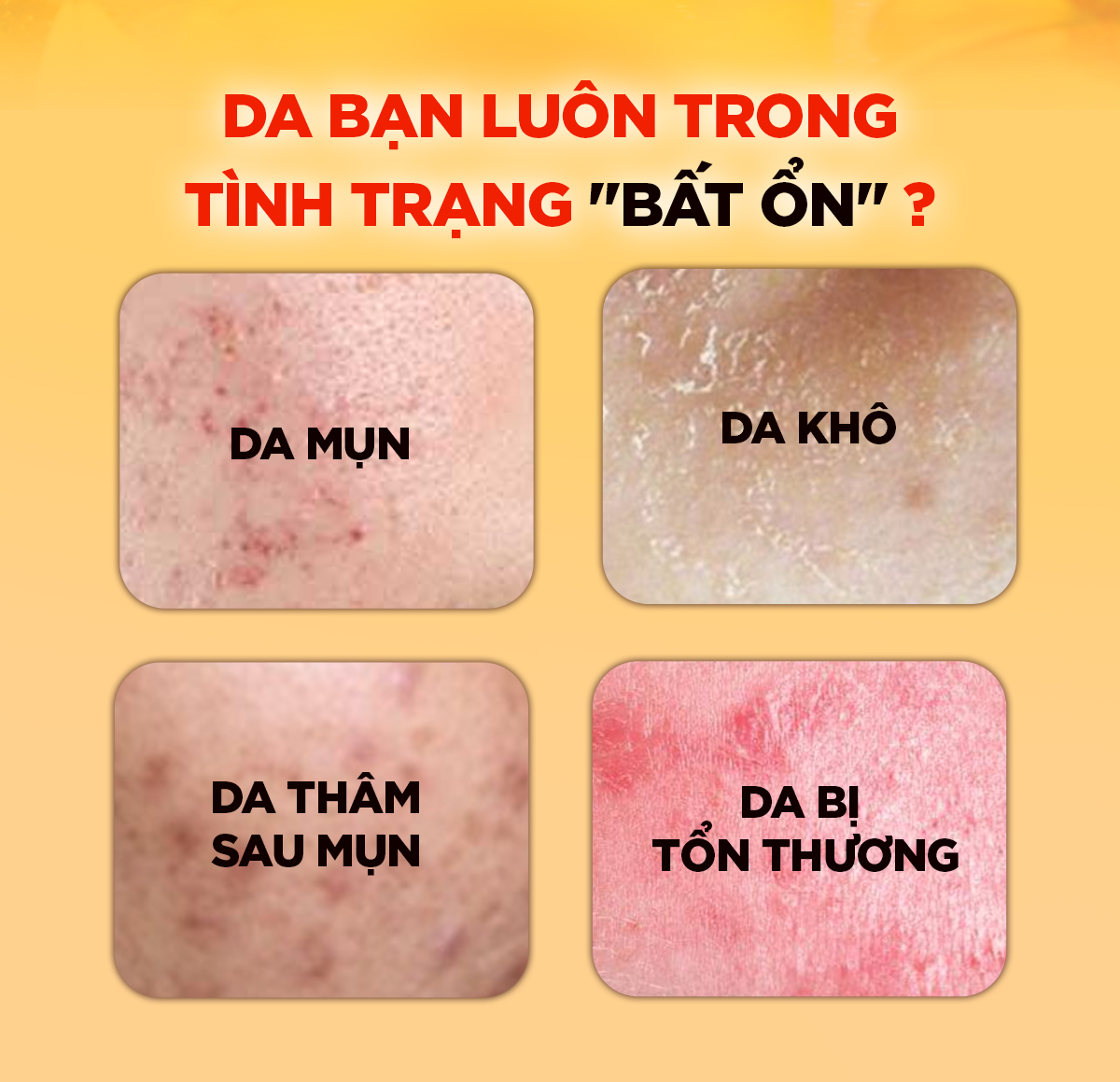 Mô tả Serum Cam, Làm Dịu Da mụn, Phục hồi, Hỗ Trợ Giảm Mụn, Mờ Thâm - G.G.G Wonder Glow Healing Serum 40ml - 3