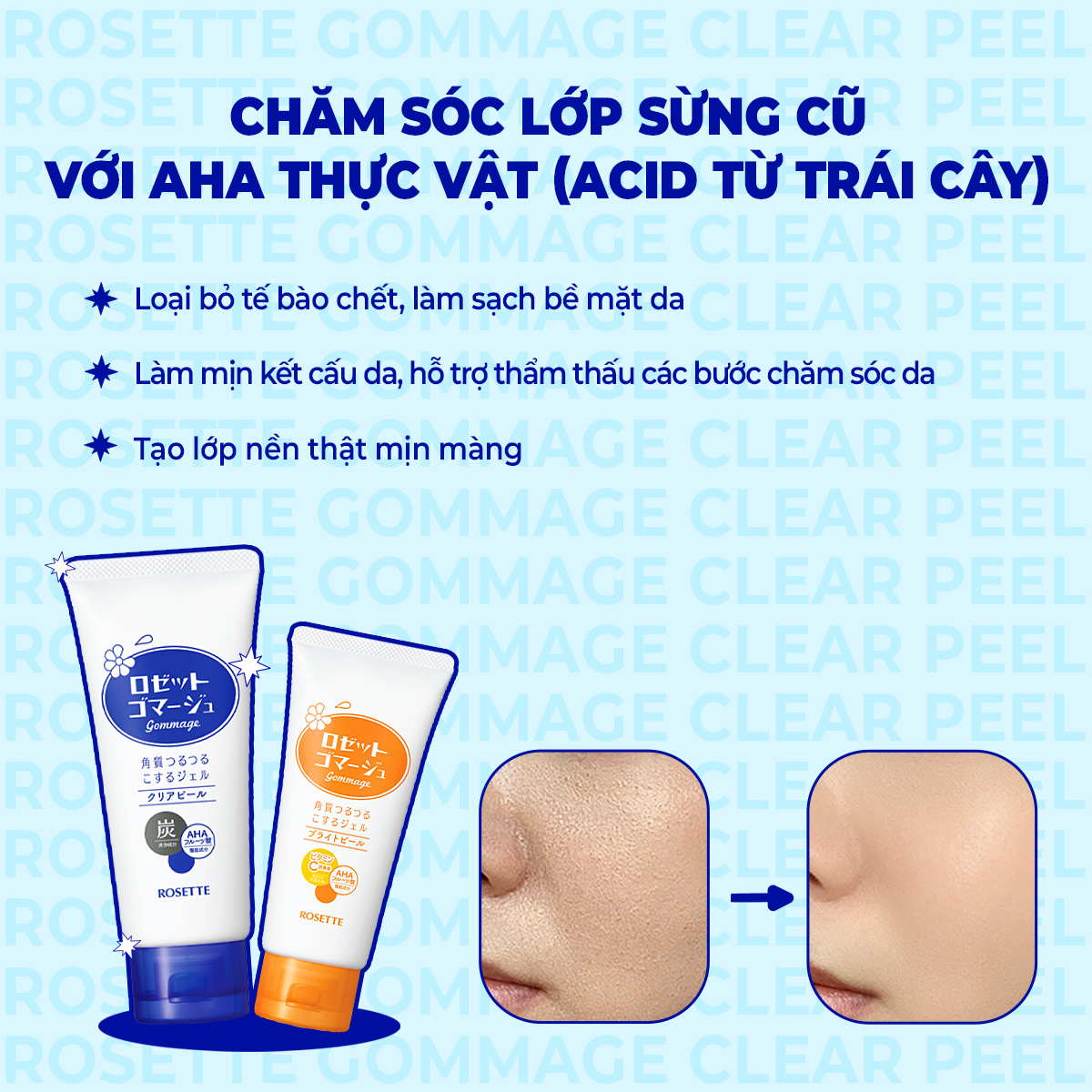 Rosette Gommage Nhật Bản