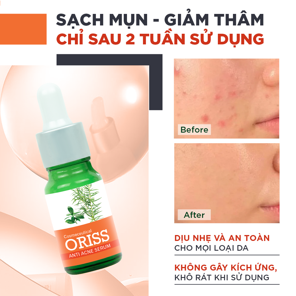 Mô tả Serum giảm mụn Oriss tinh chất tràm trà hỗ trợ mờ thâm sạch mụn 10g - 3