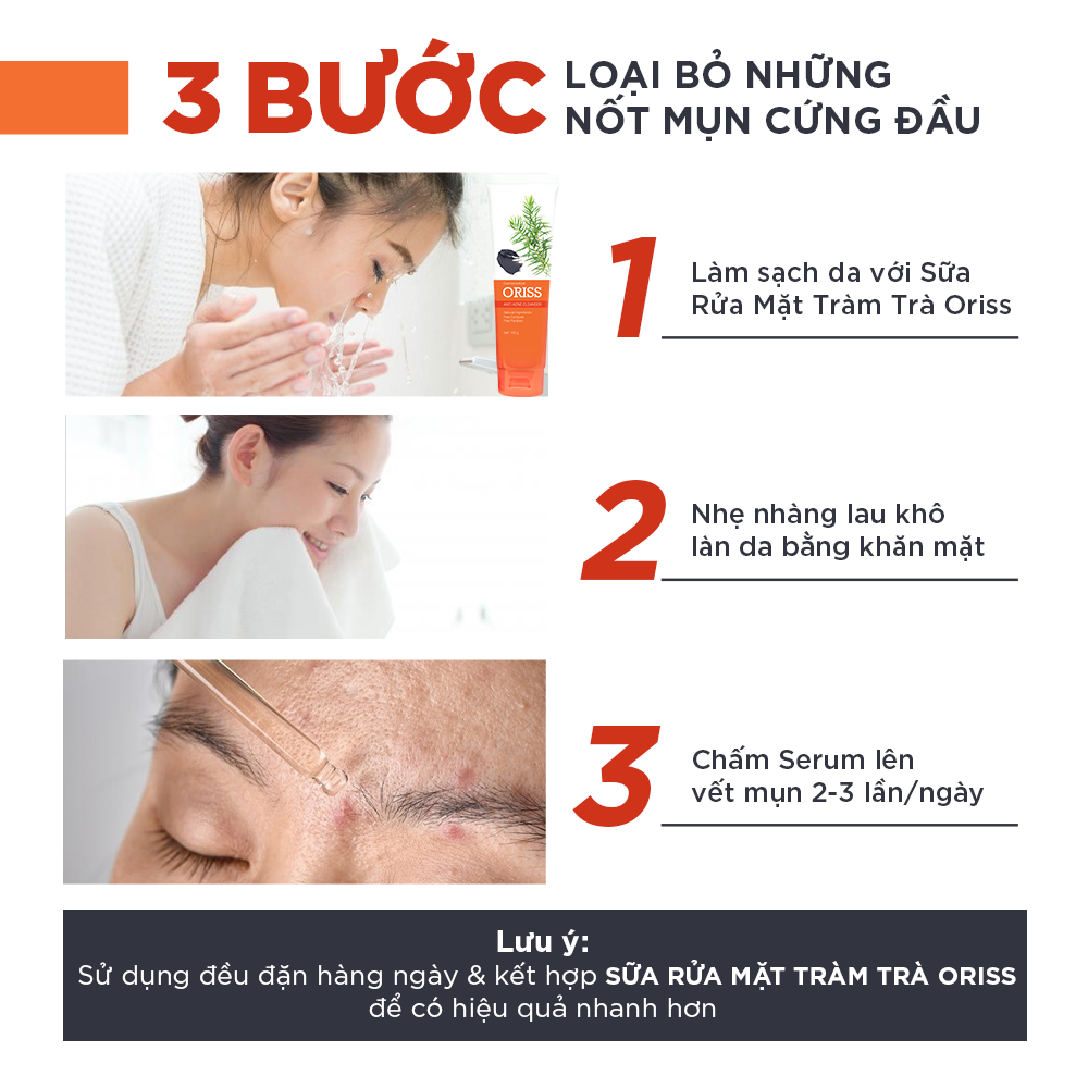 Mô tả Serum giảm mụn Oriss tinh chất tràm trà hỗ trợ mờ thâm sạch mụn 10g - 5