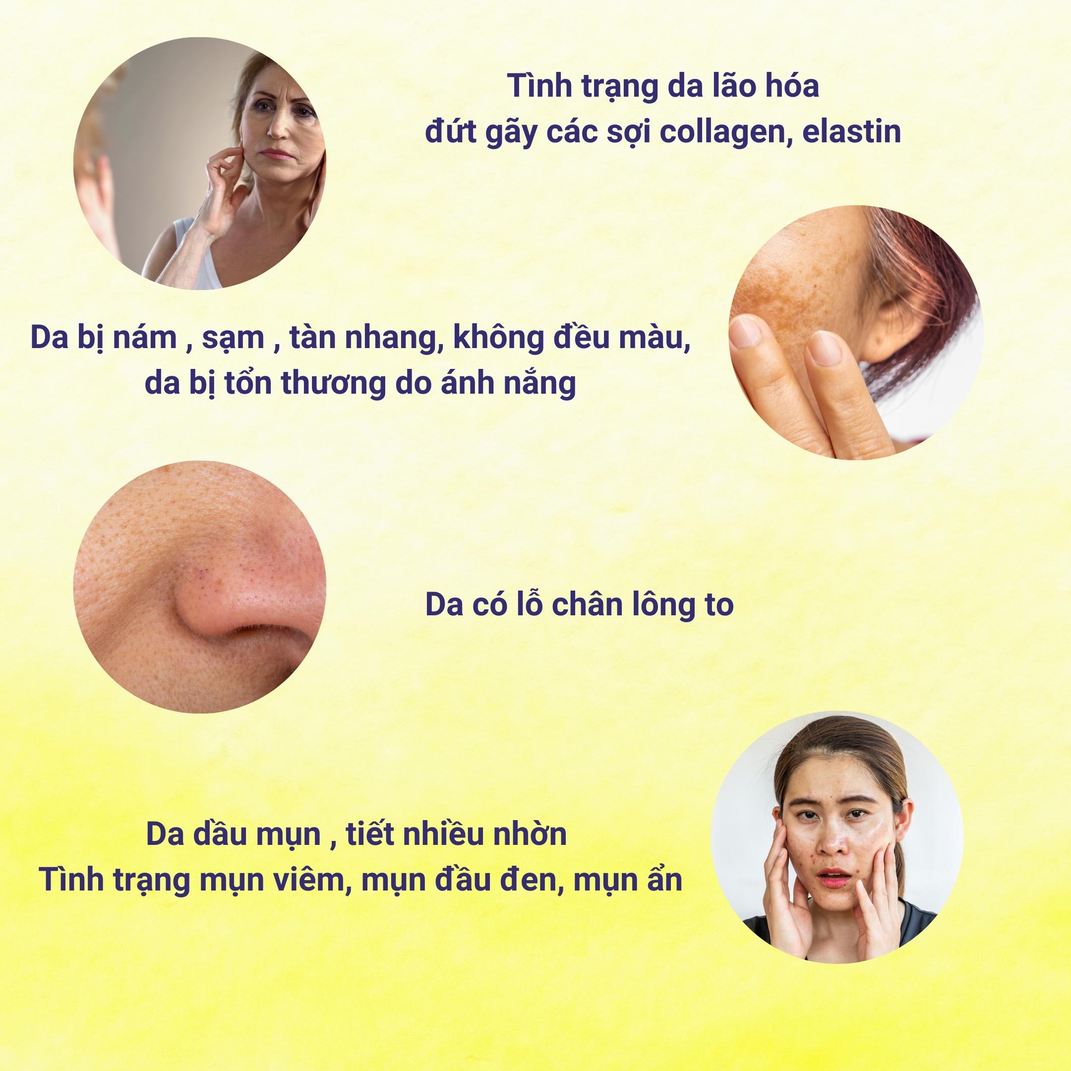 Mô tả Bột BB LAB Retinol C 1000 - Trẻ Hóa Da, Tăng Collagen, Mờ Thâm, Giảm Mụn, Se Khít Lỗ Chân Lông (30 Gói/Hộp) - 8