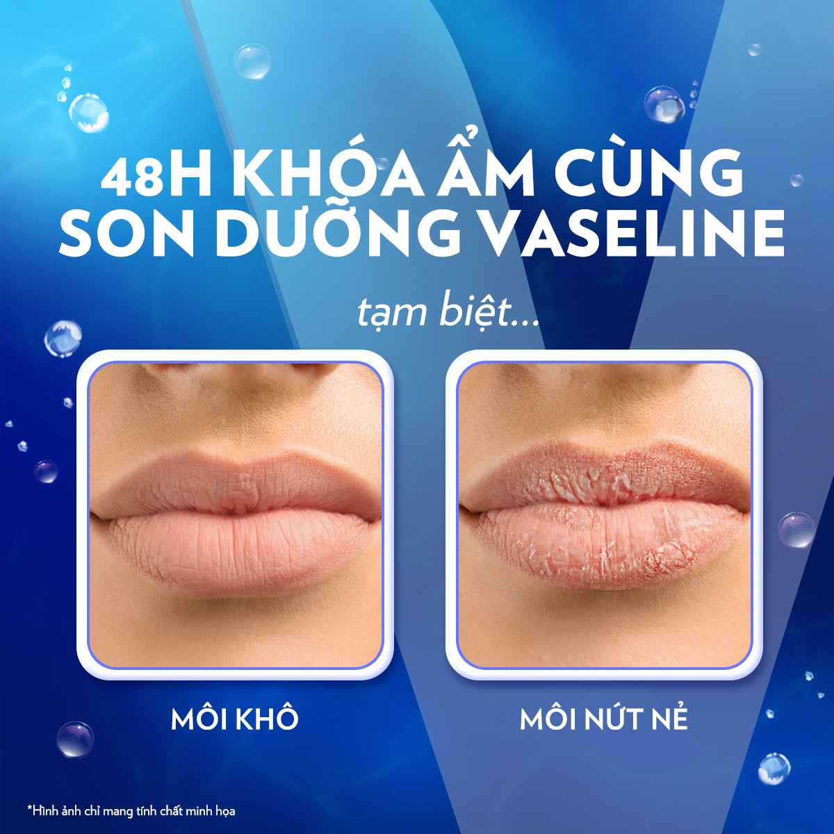 Mô tả Son Dưỡng Môi Mềm Mịn Vaseline Stick 4.8g - 7