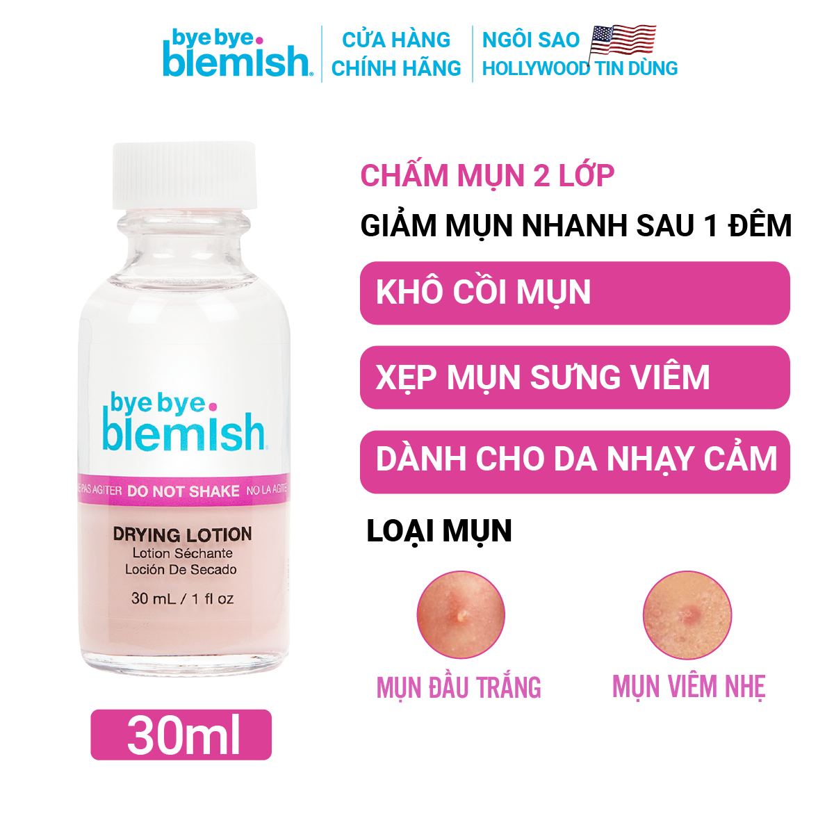 Mô tả 2 Chấm Mụn/Thâm Mụn Bye Bye Blemish cho tất cả các loại mụn trên mặt 30ml x 2 - 1