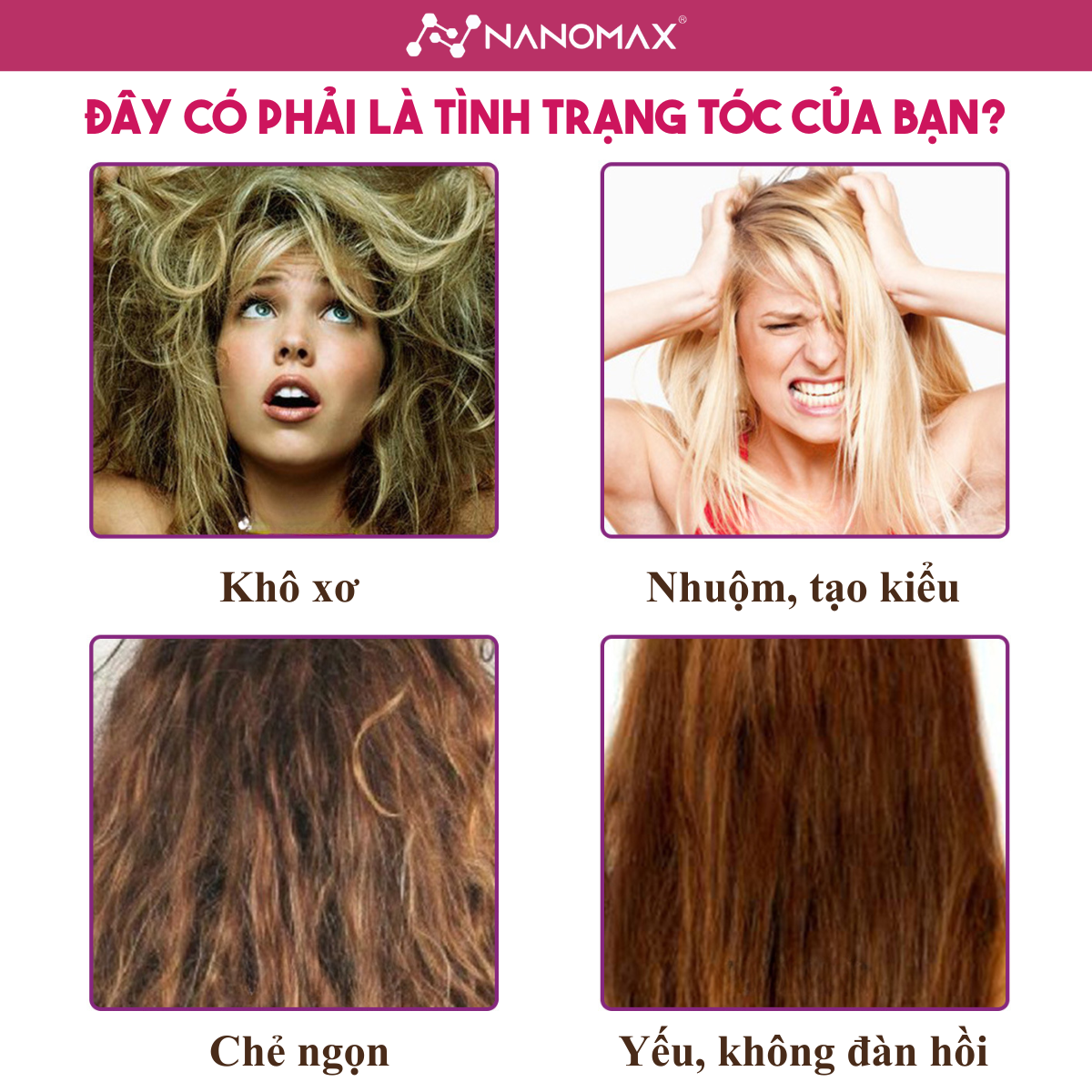 Máy sấy tóc Nanomax D087 - Hình ảnh 1