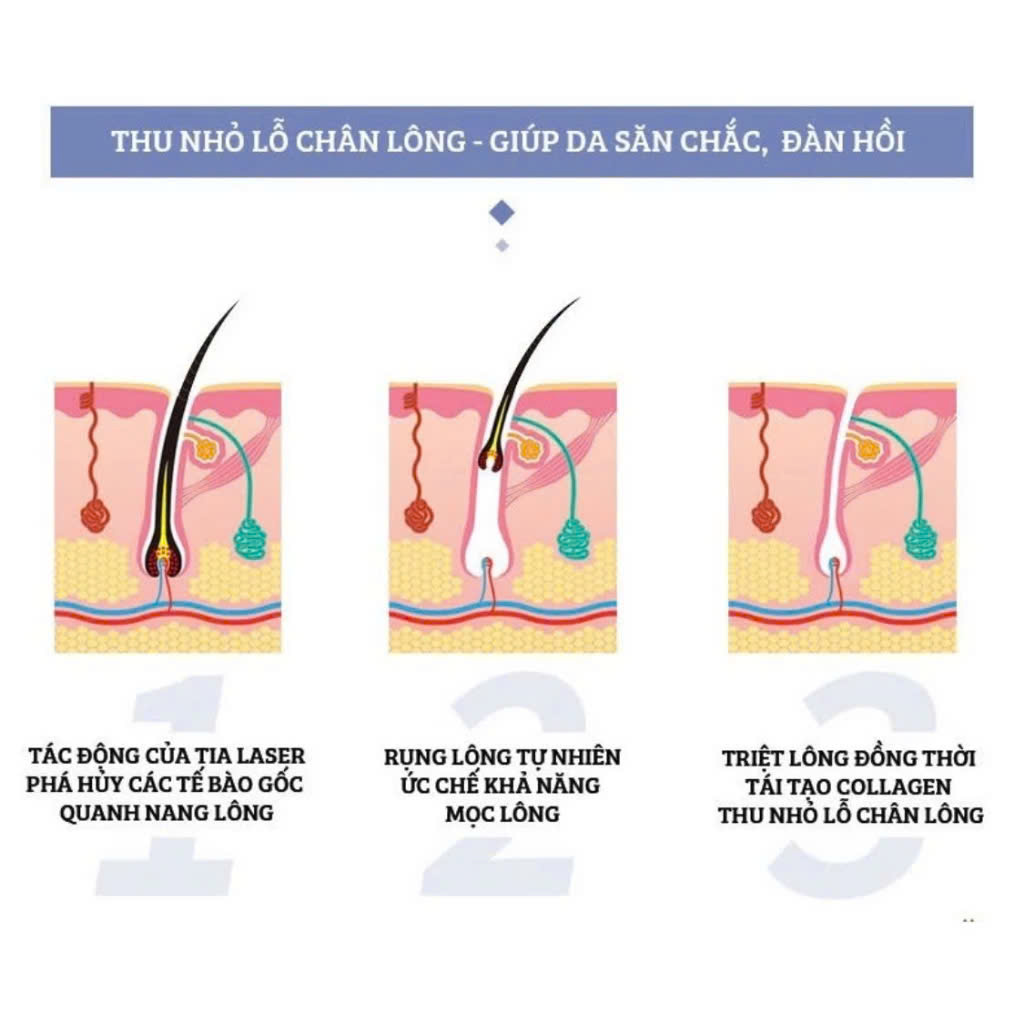 Mô tả Máy triệt lông IPL Bécot Beauté, công nghệ IPL đạt tiêu chuẩn châu âu, giúp loại bỏ lông vĩnh viễn, ENZO - 9