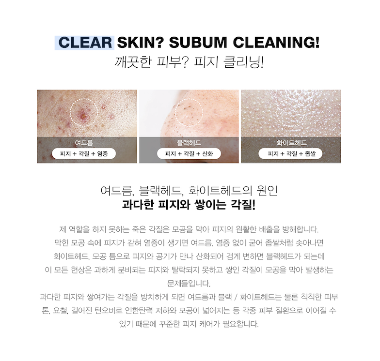 Mô tả Ủ Mụn Đầu Đen Mụn Đầu Trắng Làm Sạch Sâu Kiểm Soát Bã Nhờn Heextein Deep Sebum 1000ml - 3