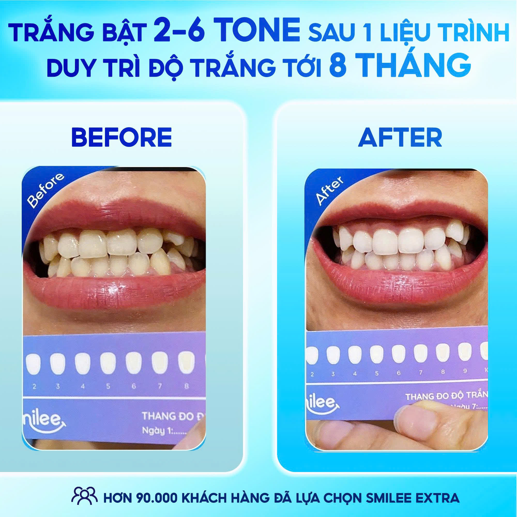 [GIÁ 657K TẠI LIVE SHOP] Trắng răng Smilee Extra, trắng răng từ 2-6 ...