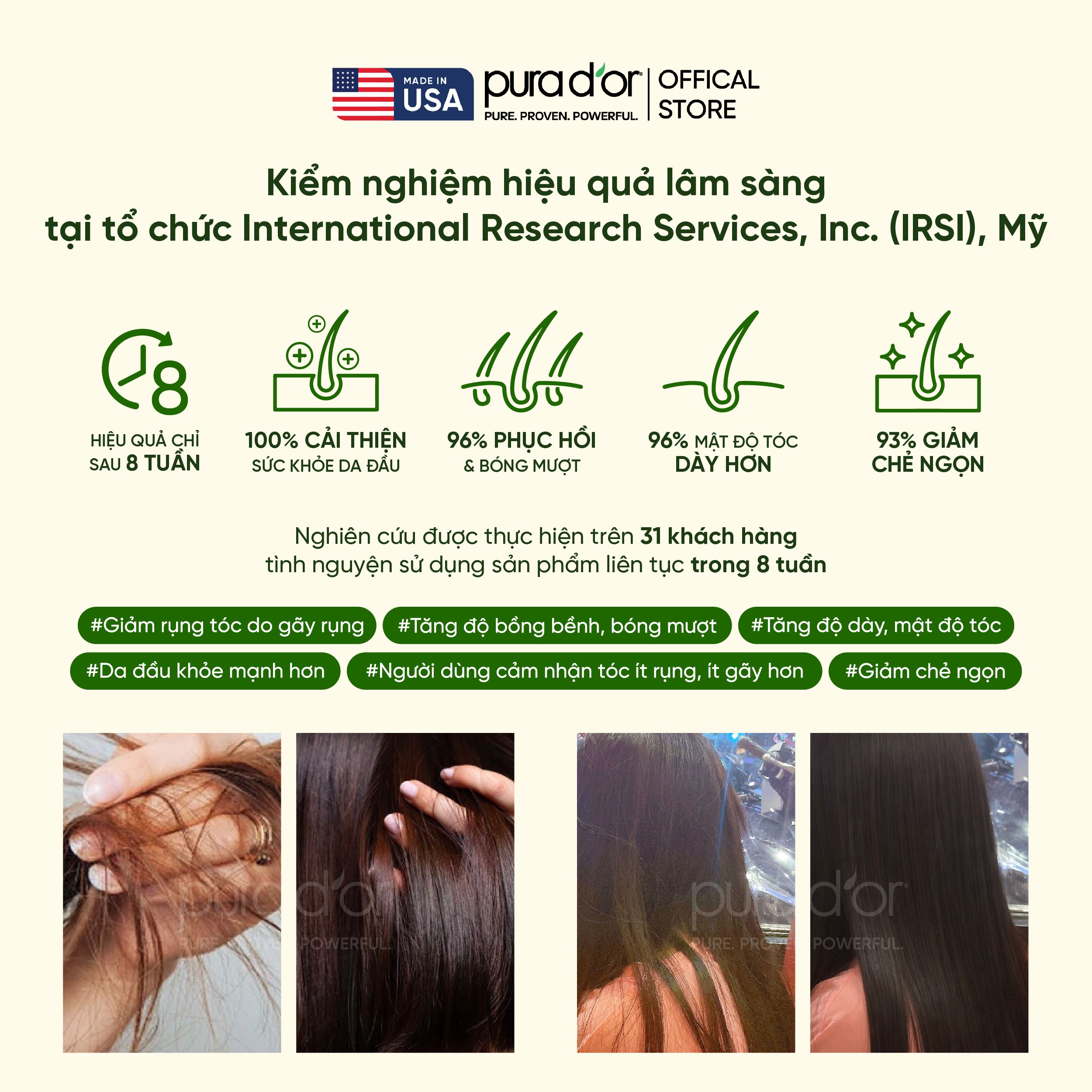 [GWP] Combo Gội Xả Biotin Hỗ Trợ Giảm Rụng & kiềm dầu, phục hồi tóc khô ...
