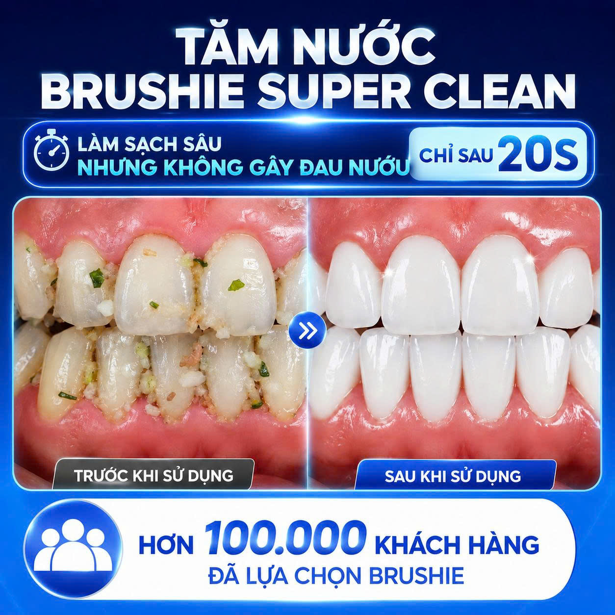 [GIÁ 607K LIVE SHOP] Tăm Nước BRUSHIE SUPER CLEAN Bản Cải Tiến Flossie ...