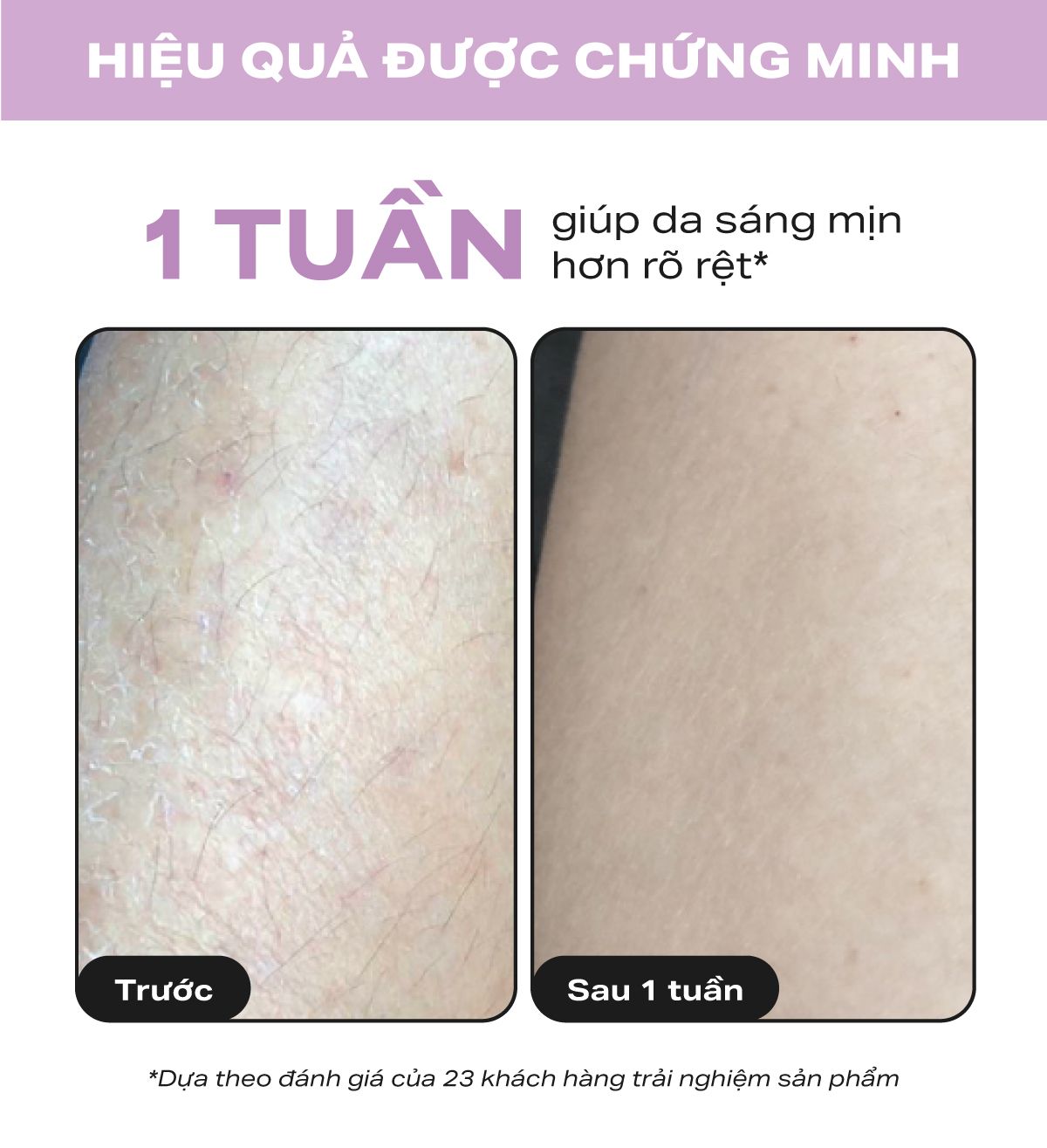 Kem dưỡng thể làm sáng da và làm đều màu da Paula's Choice Skin Revealing Body Lotion 10% AHA 210ml 5900