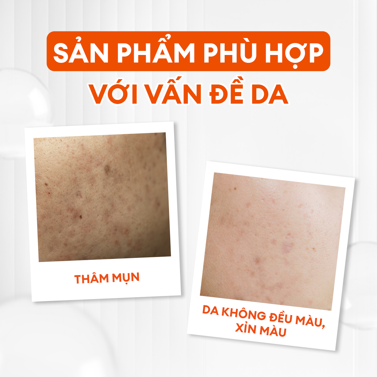 Serum Vital dưỡng trắng mờ thâm cho nam phức hợp Peptide + 5% Niacinamide Men Stay Simplicity 30ml