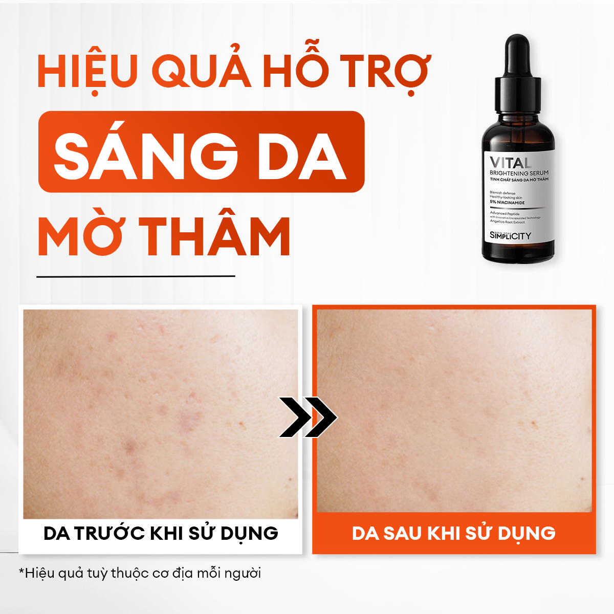 Serum Vital dưỡng trắng mờ thâm cho nam phức hợp Peptide + 5% Niacinamide Men Stay Simplicity 30ml