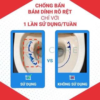 Nước Tẩy Rửa Bồn Cầu Với Vòi Xịt Đa Năng Kincho 300ml