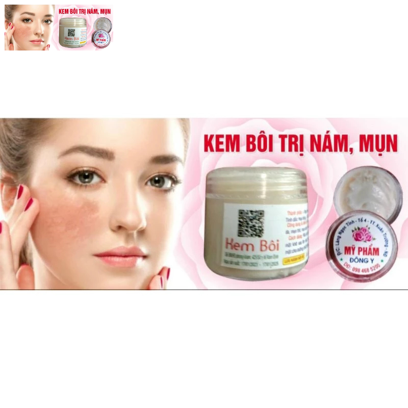 Mỹ Phẩm Đông Y Kem Bôi nám