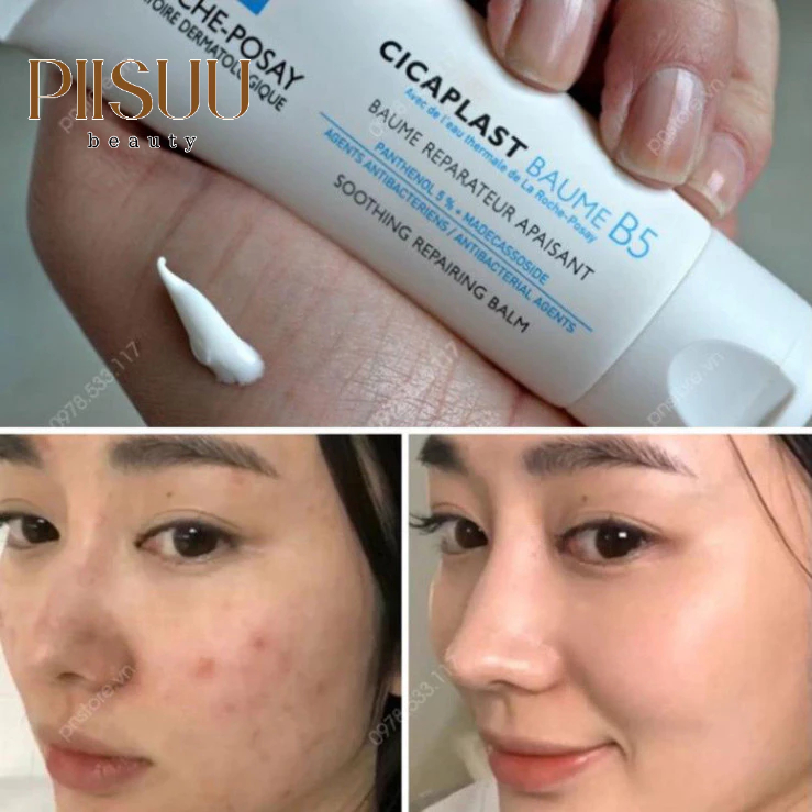 Kem Dưỡng La Roche-Posay Cicaplast Baume B5 (40ml/100ml) - Phục Hồi, Làm Dịu Da Tổn Thương & Giảm Kích Ứng