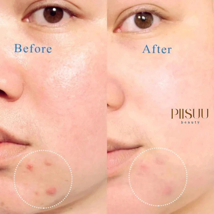 Sữa Rửa Mặt La Roche-Posay Effaclar Purifying Foaming Gel- Gel Rửa Mặt Cho Da Dầu Mụn, Giảm Nhờn & Thanh Lọc Da 400ml