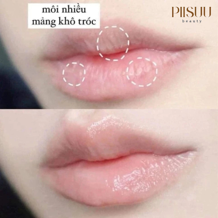 Son dưỡng môi keo ong đa năng CNP Laboratory Propolis Lipcerin phục hồi và giữ ẩm môi