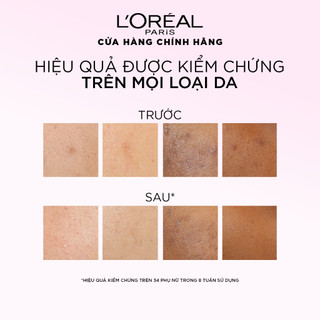 VB_ Bộ dưỡng chất peel sáng da làm sạch tế bào da chết Peel 25ml & Serum siêu cấp ẩm 1.5% HA L'Oréal Paris 30ml