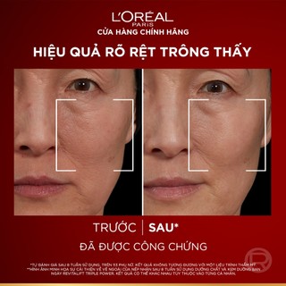VB_Bộ dưỡng chất serum, kem dưỡng SPF25 peptides giảm nhăn, săn chắc da L'Oreal Paris Revitalift Triple Power 30ml, 50ml