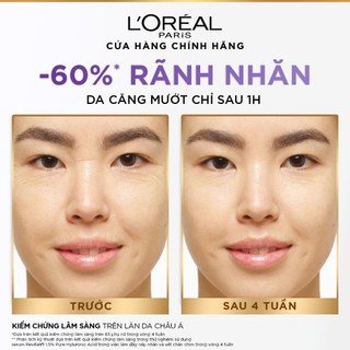 VB_Bộ chăm sóc da Serum HA 1.5% và Kem dưỡng siêu cấp ẩm, giảm nếp nhăn  L'Oreal Paris Revitalift HA (30ml & 50ml)