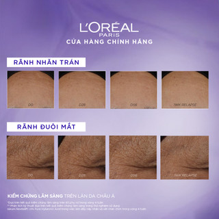 VB_ Bộ kem dưỡng ngày và đêm chống rãnh nhăn lão hóa sớm Revitalift Line Hyaluronic Acid L'Oreal Paris 50mlx2