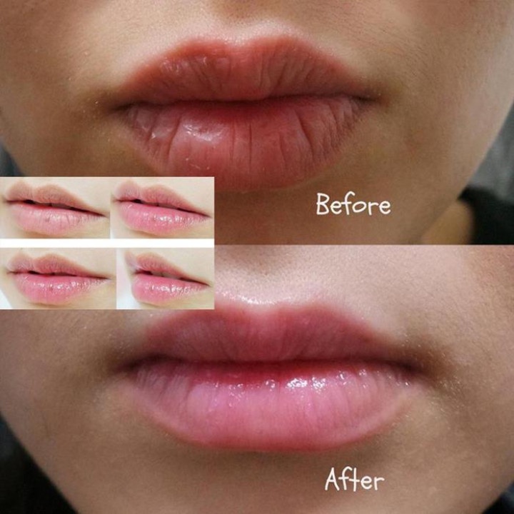 Son Dưỡng Môi Collagen, Khử Thâm Môi, Dưỡng Môi Mềm Mại, Kích Màu Môi Sau Phun Xăm [Phiên Bản Mới]